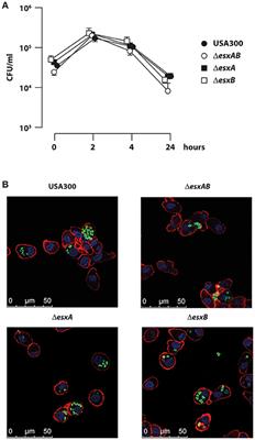 Staphylococcus aureus Esx Factors Control Human Dendritic Cell Functions Conditioning Th1/Th17 Response
